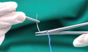 Plastering & Suturing @ University Centre for Rural Health